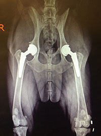 Total Hip Replacement (THR)