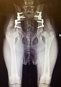 Triple Pelvic Osteotomy (TPO)